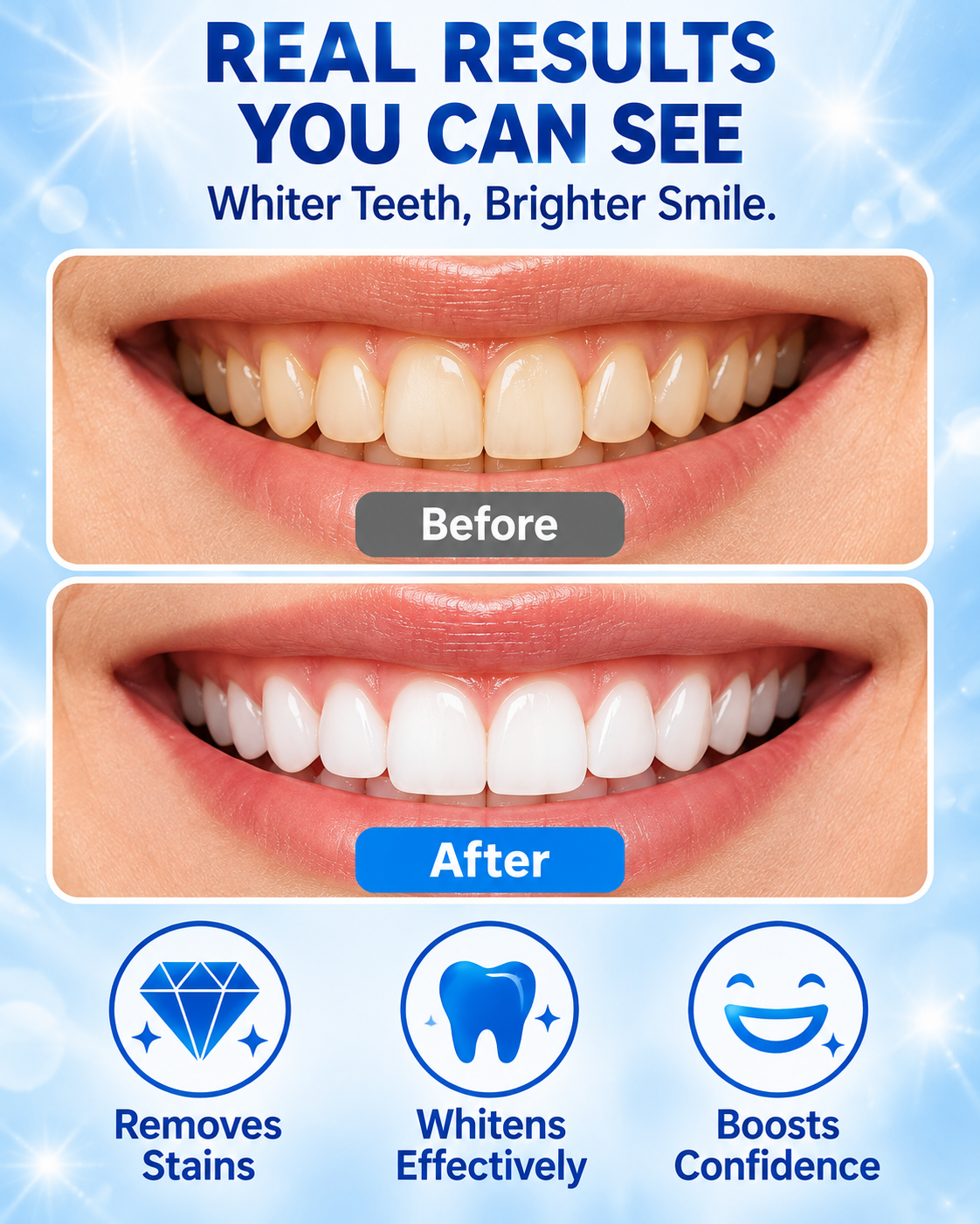 bboji 5D White Teeth Whitening Strips – Enamel-Friendly 3-Day Bright Smile Kit