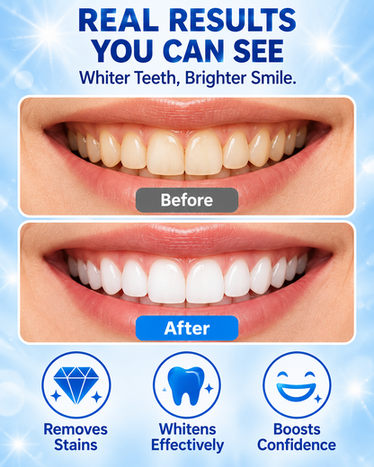 bboji 5D White Teeth Whitening Strips – Enamel-Friendly 3-Day Bright Smile Kit